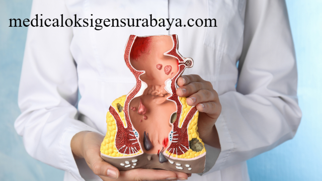 Tips Mencegah Masalah Pencernaan